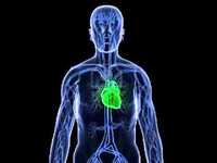 pochette album A storm breaks