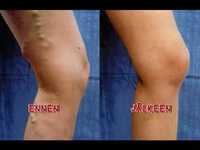 pochette album Jeesus tulee