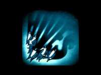 pochette album 1000 answers