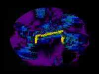 pochette album Birmingham turnaround