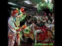 pochette album Skinned