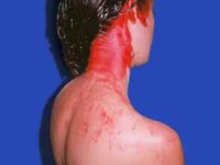 pochette album Spilling lines