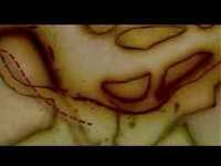 pochette album Ca va faire mal