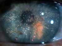 pochette album One more kiss dear