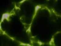 pochette album Stillborn